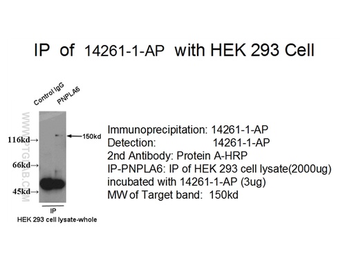 [14261-1-AP-150UL] PNPLA6 Polyclonal antibody