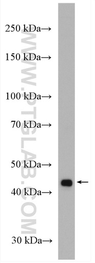 [14262-1-AP-150UL] VPS36 Polyclonal antibody