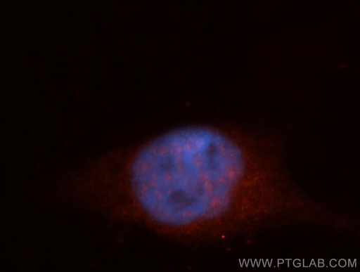 [14267-1-AP-150UL] ITPKC Polyclonal antibody