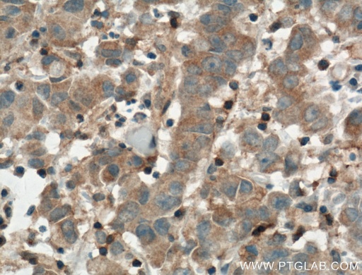 [14268-1-AP-150UL] ARNTL Polyclonal antibody