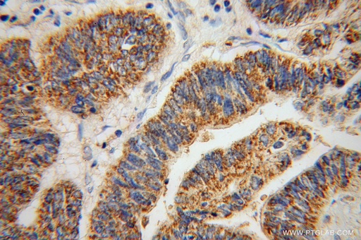 [14269-1-AP-20UL] ABCG4 Polyclonal antibody