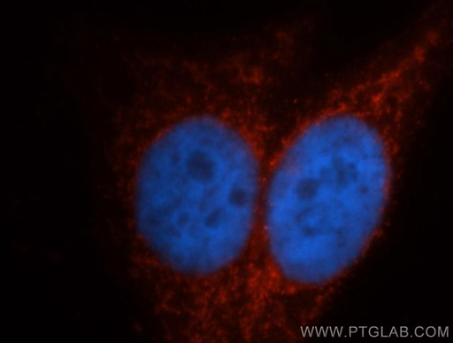 [14270-1-AP-150UL] ITPKA Polyclonal antibody