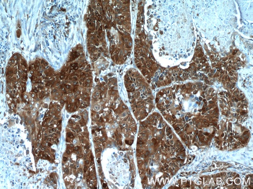 [14273-1-AP-20UL] SRX1 Polyclonal antibody