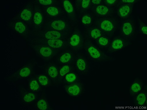 [14275-1-AP-150UL] FBXO18 Polyclonal antibody