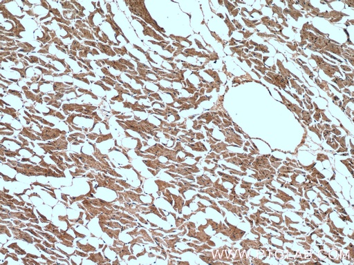 [14276-1-AP-20UL] CNOT1 Polyclonal antibody