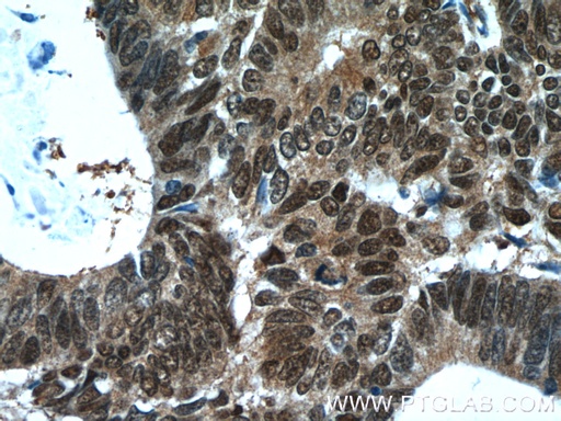 [14281-1-AP-20UL] ZWILCH Polyclonal antibody