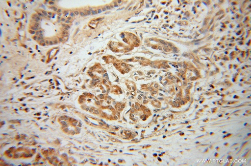 [14282-1-AP-150UL] ARHGDIG Polyclonal antibody