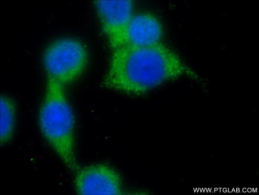 [14284-1-AP-150UL] RAB26 Polyclonal antibody