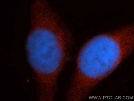 [14291-1-AP-20UL] Renin Polyclonal antibody