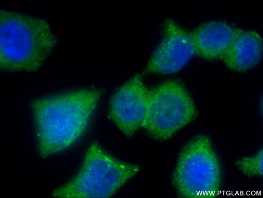 [14294-1-AP-20UL] APPL2 Polyclonal antibody