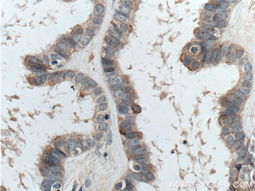 [14296-1-AP-150UL] CTSO Polyclonal antibody