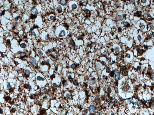 [14299-1-AP-20UL] GLUD1 Polyclonal antibody