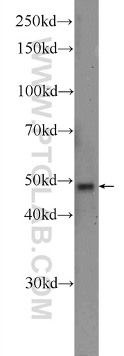 [14303-1-AP-150UL] SCRN1 Polyclonal antibody