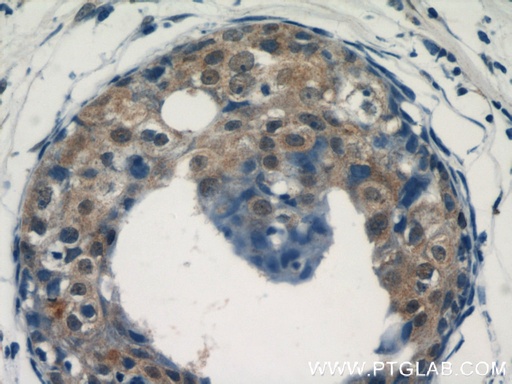 [14304-1-AP-20UL] ACK1 Polyclonal antibody