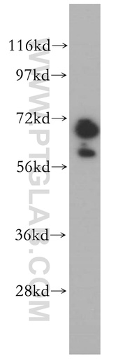 [14305-1-AP-150UL] GAN Polyclonal antibody