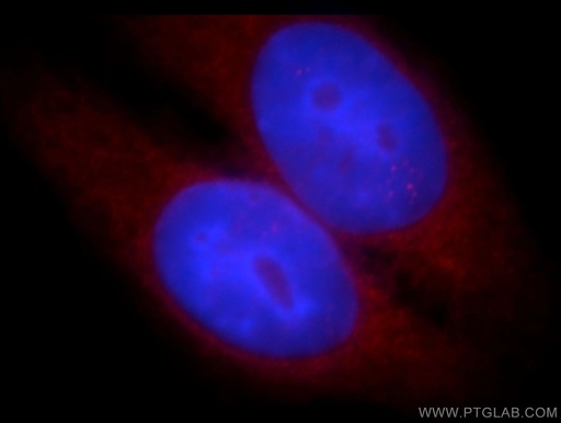 [14306-1-AP-20UL] WASL Polyclonal antibody