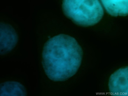 [14307-1-AP-150UL] CDC16/APC6 Polyclonal antibody
