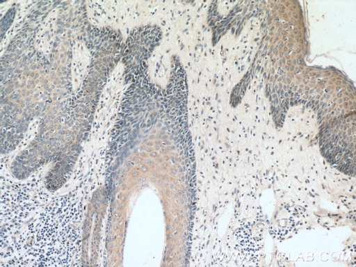 [14309-1-AP-150UL] KRT36 Polyclonal antibody