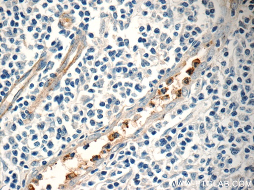 [14310-1-AP-150UL] NFAM1 Polyclonal antibody