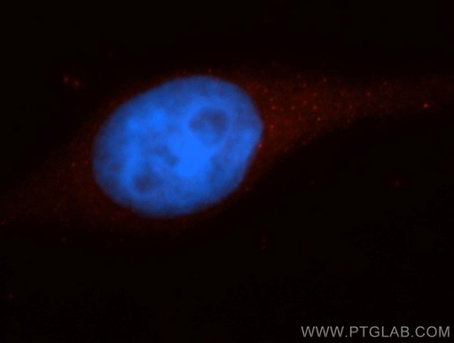 [14311-1-AP-150UL] Caspase 10/p23/17/p12 Polyclonal antibody