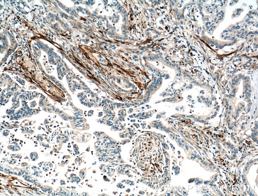 [14322-1-AP-20UL] VWA1 Polyclonal antibody