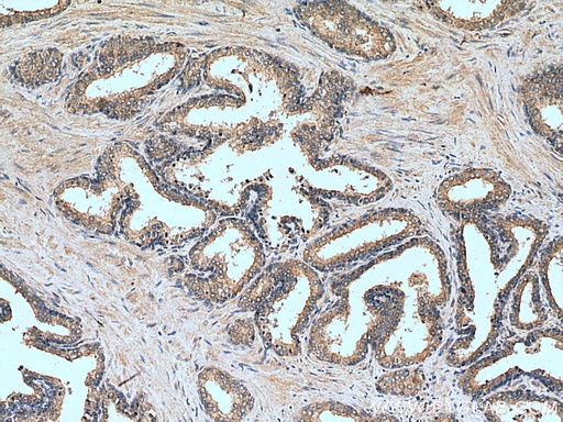 [14324-1-AP-20UL] BCO2 Polyclonal antibody