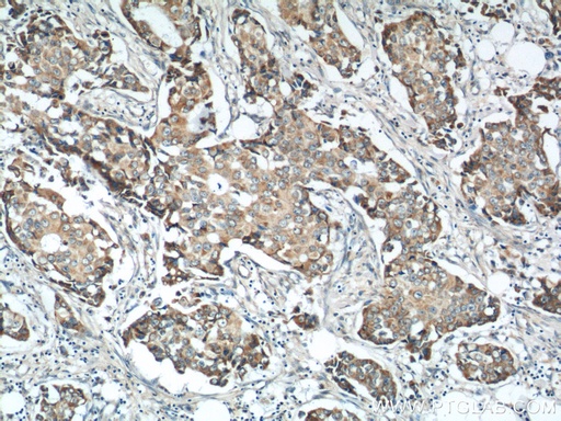 [14325-1-AP-20UL] MICB Polyclonal antibody