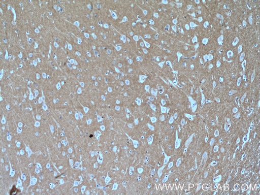 [14326-1-AP-20UL] RHOB Polyclonal antibody