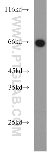 [14327-1-AP-20UL] PGT Polyclonal antibody
