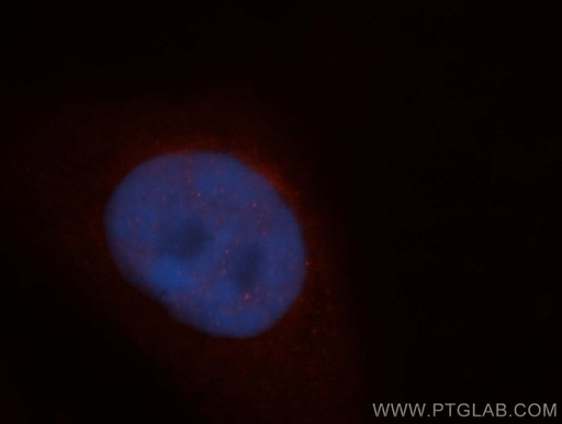 [14330-1-AP-20UL] ADAR1 Polyclonal antibody