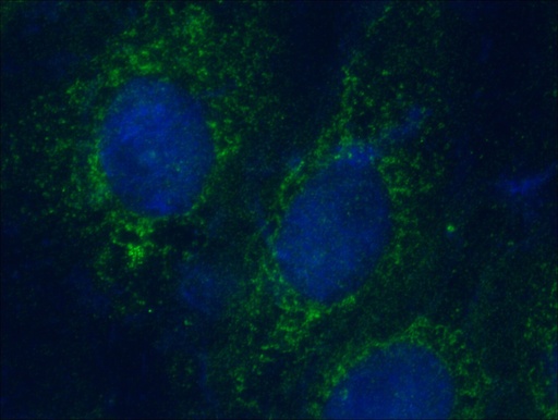 [14333-1-AP-150UL] KIF3C Polyclonal antibody