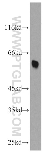 [14335-1-AP-150UL] CADM1 Polyclonal antibody