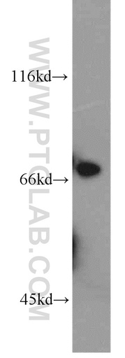 [14337-1-AP-150UL] Collagen Type XXIII Polyclonal antibody