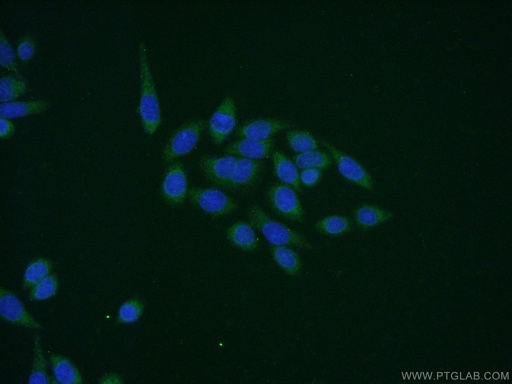 [14339-1-AP-150UL] MAPKAPK5 Polyclonal antibody