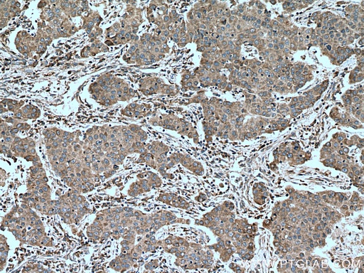 [14340-1-AP-150UL] PALB2 Polyclonal antibody