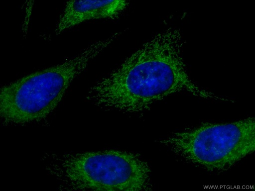 [14341-1-AP-150UL] MAVS; VISA Polyclonal antibody