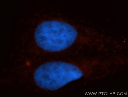 [14344-1-AP-150UL] KIF4A Polyclonal antibody