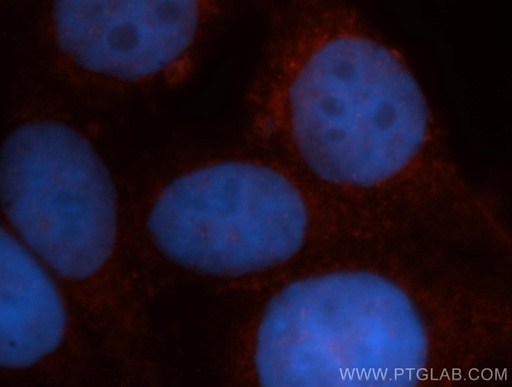 [14345-1-AP-150UL] VBP1 Polyclonal antibody