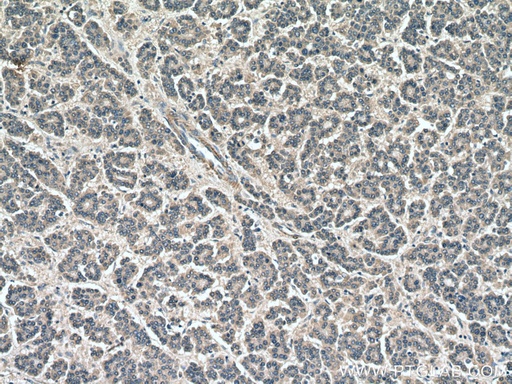 [14346-1-AP-150UL] USP1 Polyclonal antibody