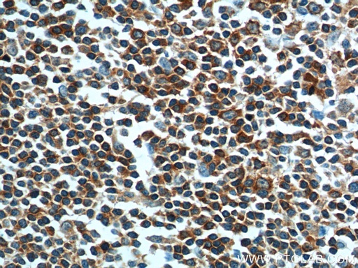 [14349-1-AP-20UL] ARHGAP25 Polyclonal antibody