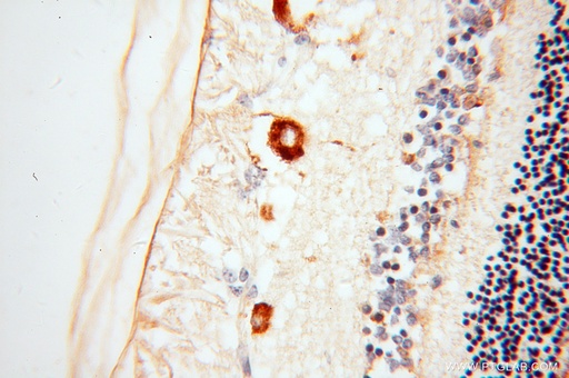 [14352-1-AP-150UL] RBP3 Polyclonal antibody