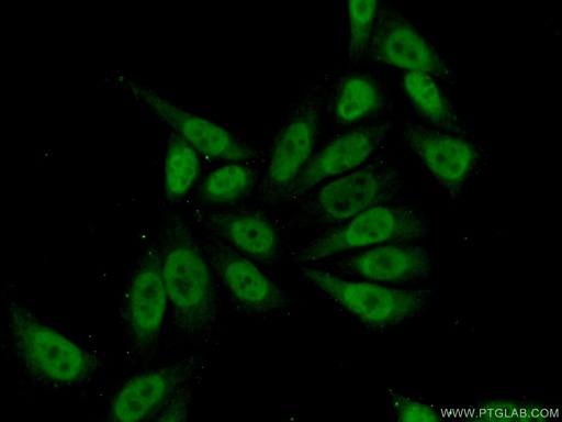 [14353-1-AP-150UL] MEF2D Polyclonal antibody