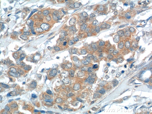 [14354-1-AP-150UL] USP15 Polyclonal antibody