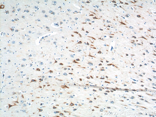 [14357-1-AP-20UL] PTGER3 Polyclonal antibody