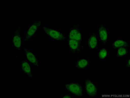 [14360-1-AP-150UL] RBM6 Polyclonal antibody