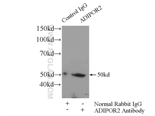 [14361-1-AP-150UL] Adiponectin receptor Polyclonal antibody