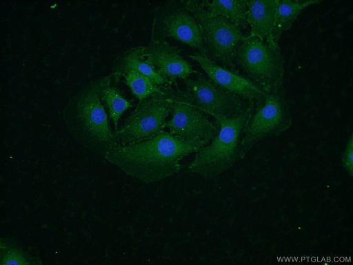 [14362-1-AP-20UL] Alpha N-Catenin Polyclonal antibody