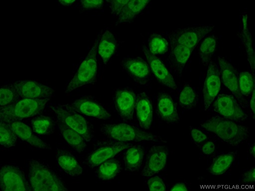 [14363-1-AP-150UL] RBM3 Polyclonal antibody