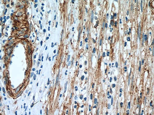 [14365-1-AP-150UL] VAP1 Polyclonal antibody