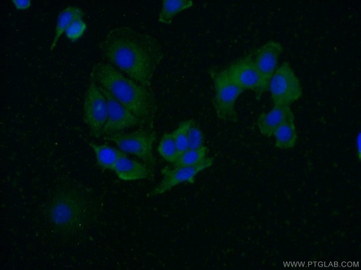 [14366-1-AP-150UL] FAM175A Polyclonal antibody